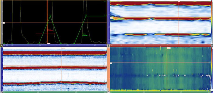Subsea Phased Array Sample Data